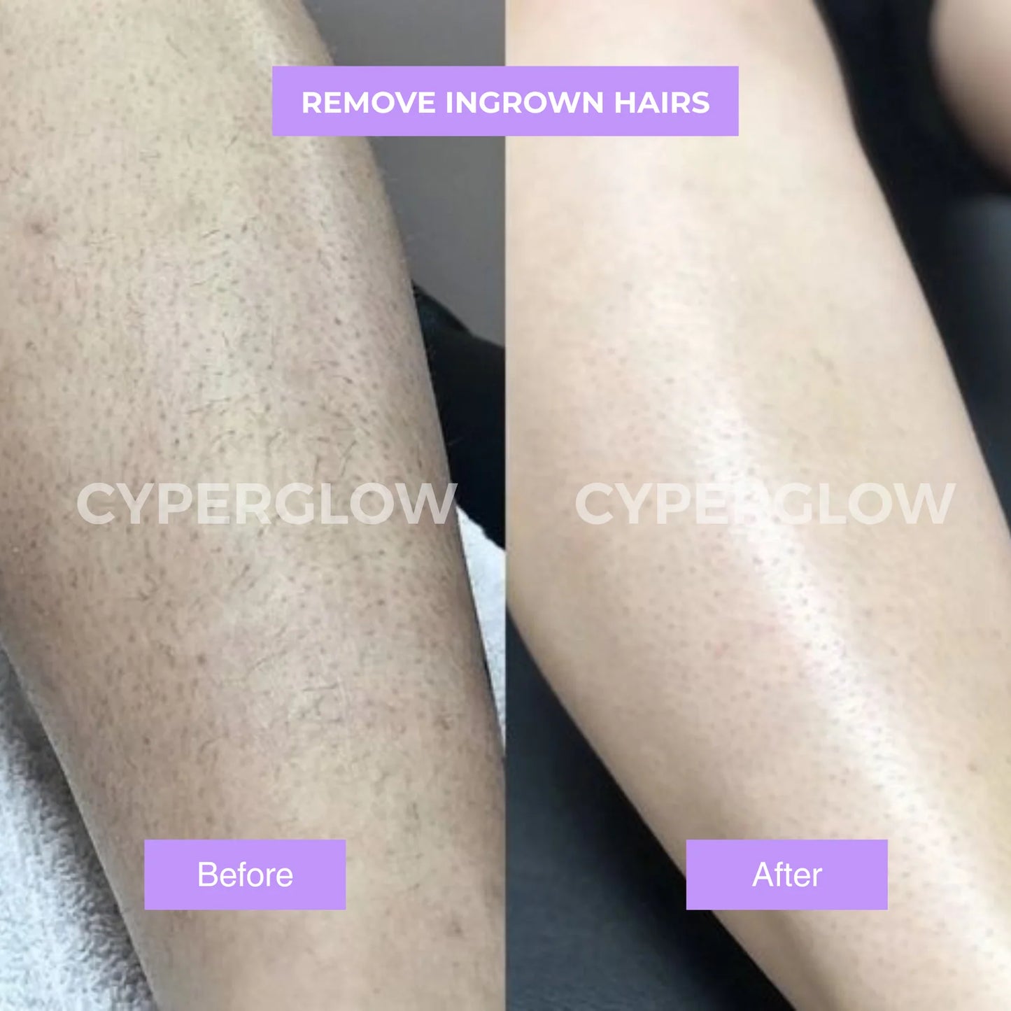 CyperGlow™ - Cyperus Rotundus Skin Serum.