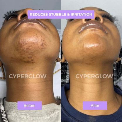CyperGlow™ - Cyperus Rotundus Skin Serum.