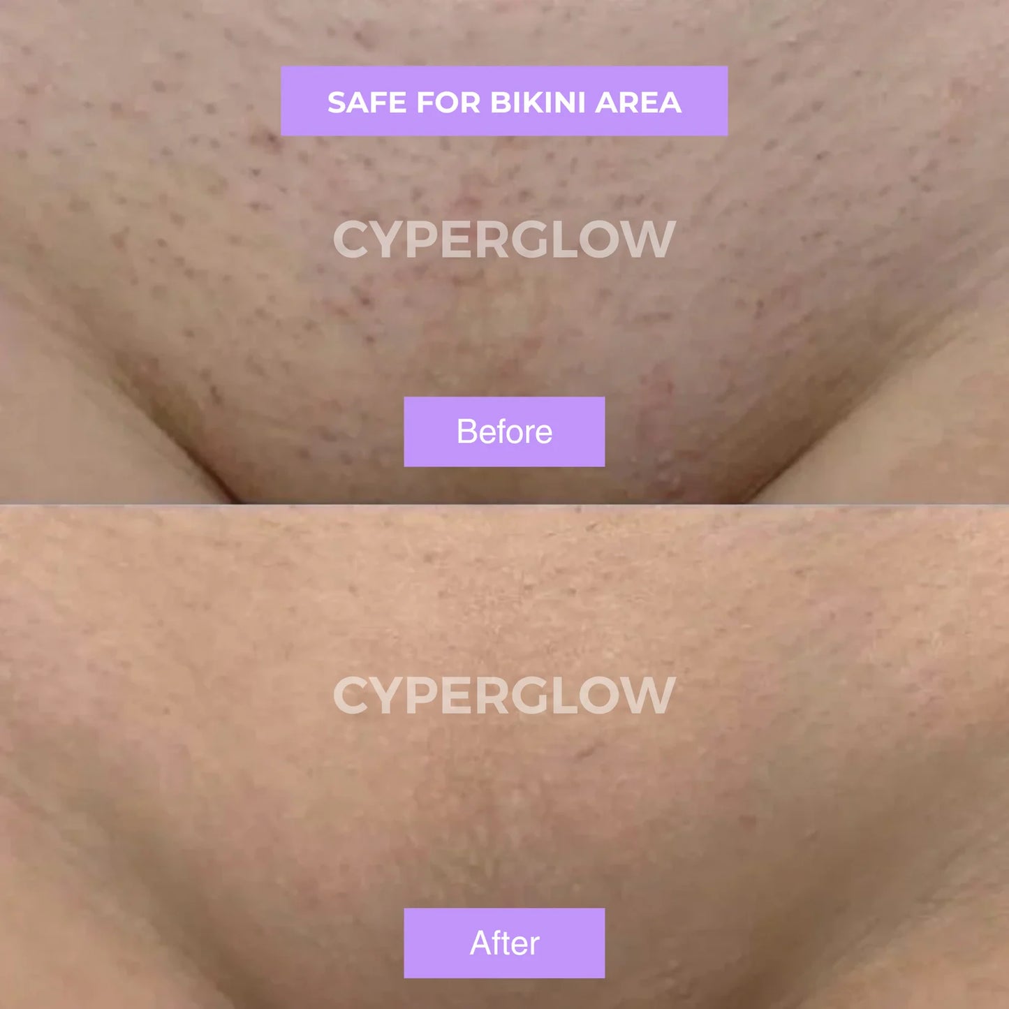 CyperGlow™ - Cyperus Rotundus Skin Serum.