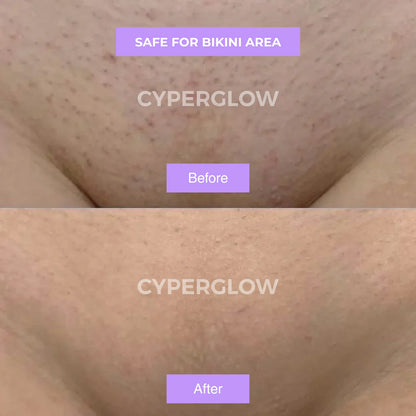 CyperGlow™ - Cyperus Rotundus Skin Serum.