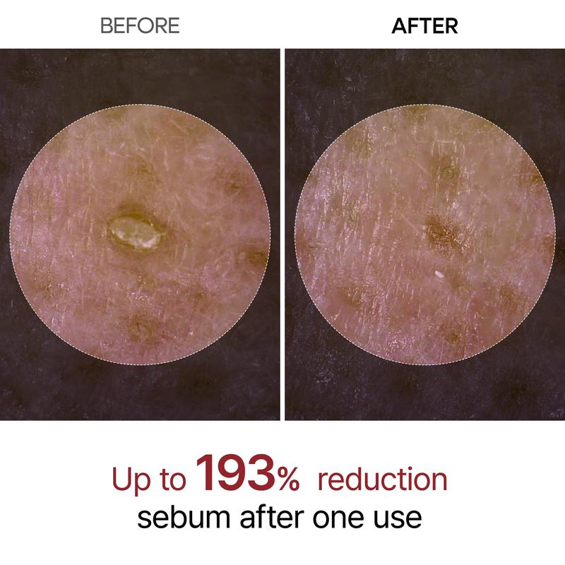 Peel Shot Glow Rice Ampoule